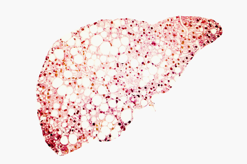 脂肪肝肝組織